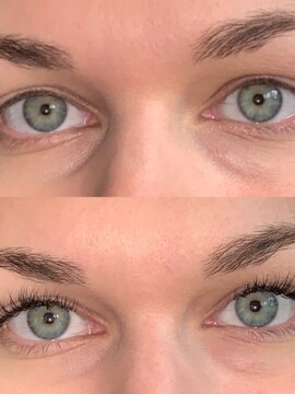 Before And After Atlanta Lash Extensions