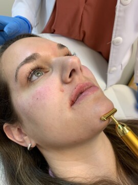 Swan Center Alpharetta Dermal Filler & Botox Review - Jordan Dupree