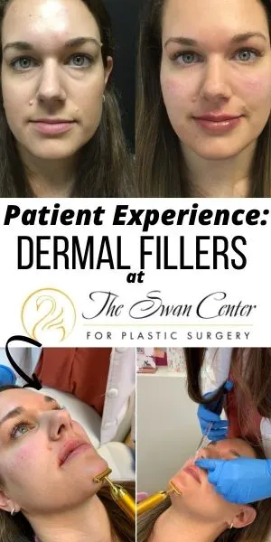 Swan Center Alpharetta Botox & Filler Review